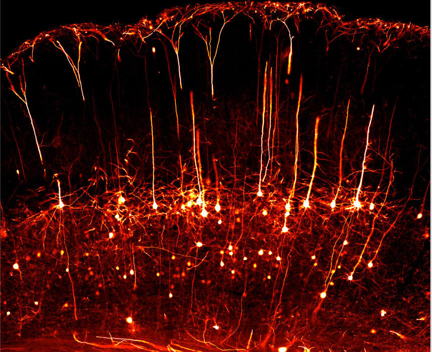 neurone_5.jpg